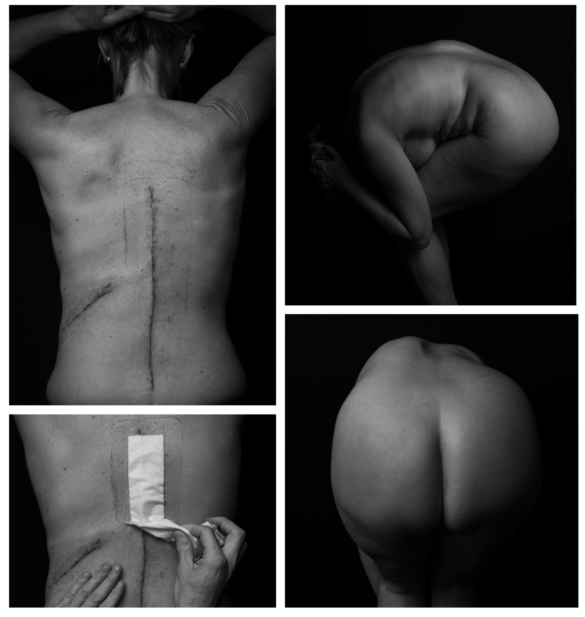 Black and White category winner, Natalie Perrin, Bent not Broken.